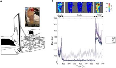 Mechanoreceptor sensory feedback is impaired by pressure induced cutaneous ischemia on the human foot sole and can predict cutaneous microvascular reactivity